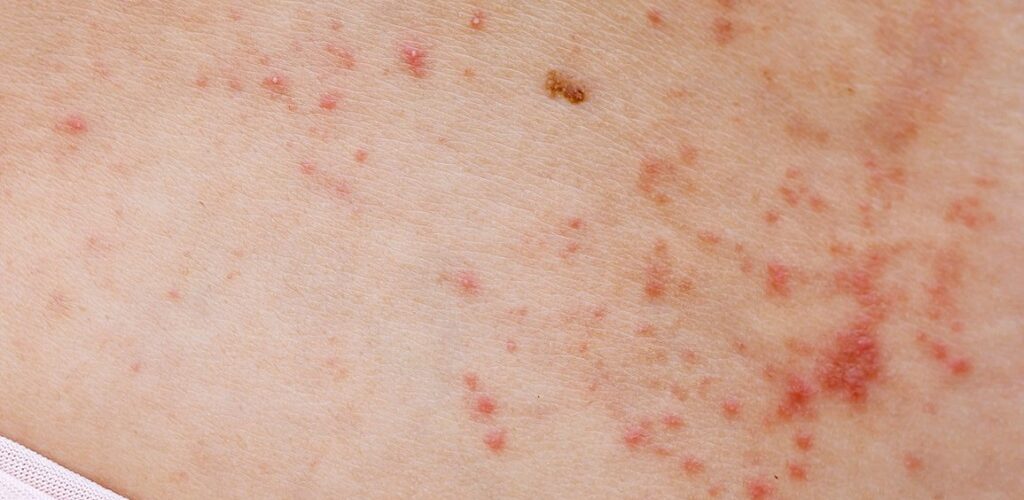 Red spots on the skin: main causes of the problem