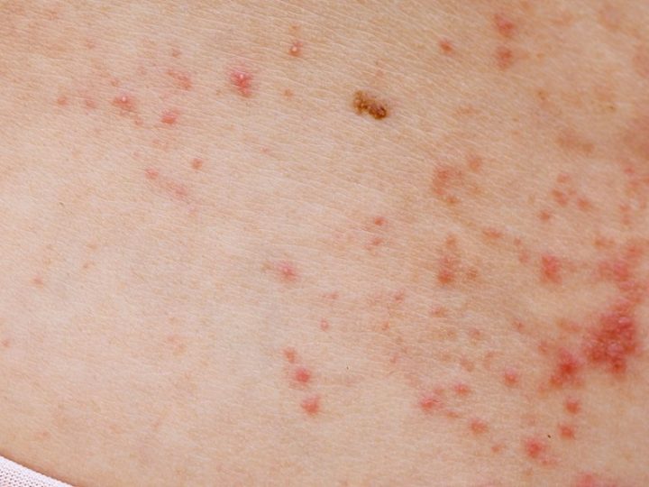 Red spots on the skin: main causes of the problem