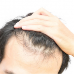 Tips to prevent hair loss